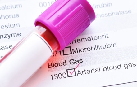 Arterial Blood Gases (ABGs) Karachi Home Health care Services (www.UNIQUE-hms.com)