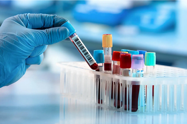 BloodTest Karachi Home Health care Services (www.UNIQUE-hms.com)