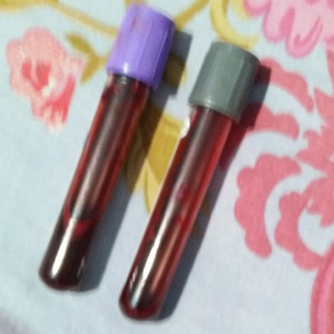 All Laboratory Services (Test) Karachi Home Health care Services (www.UNIQUE-hms.com)