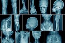 XRay DHA, Clifton, Korangi, Landhi, Saddar,  Gulshan-e-Iqbal Healthcare Home Services for Karachi UNIQUE-hms.com